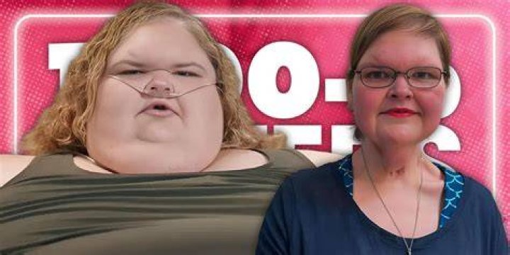 1000Lb Sisters Why Tammy's Skin Removal Surgery Is Exciting