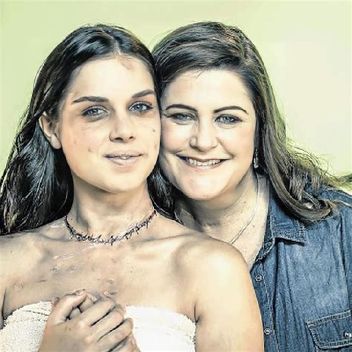 Alison Botha (left), was abducted, assaulted, stabbed 30 times
