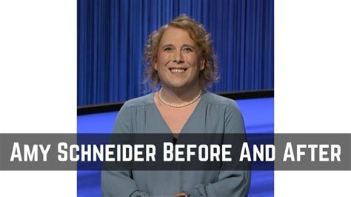Amy Schneider Before Surgery
