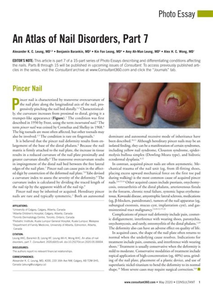 An Atlas of Nail Disorders, Part 15 Consultant360