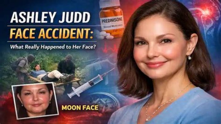 Ashley Judd Face Accident What Really Happened To Ashley Judd?
