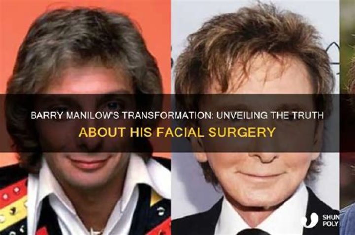 Barry Manilow Plastic Surgery, Has Barry Manilow Had Cosmetic Surgery? Barry Manilow Plastic Surgery, Has Barry Manilow Had Cosmetic Surgery?