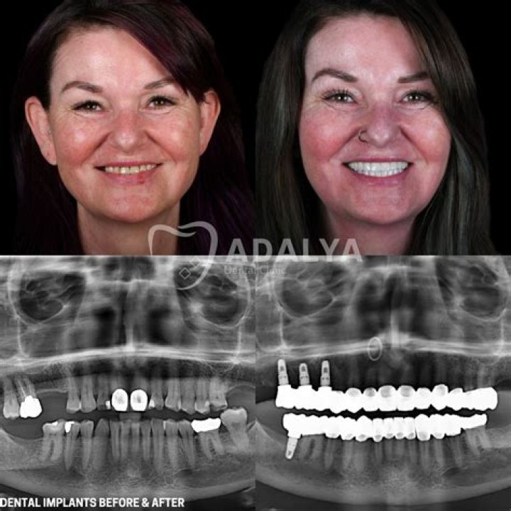 Before And After Pictures Can Show The Dramatic Results Of Cosmetic Surgery., Fashytrend