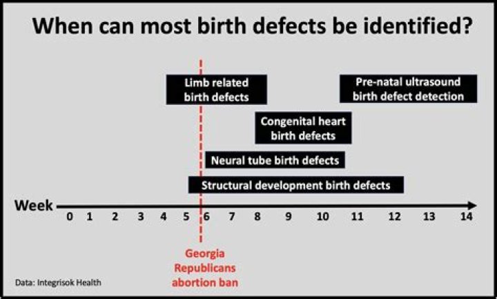 Birth Defects, Gscone