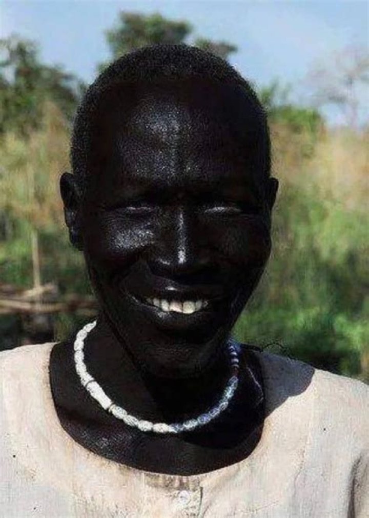 Blackest Person On Earth