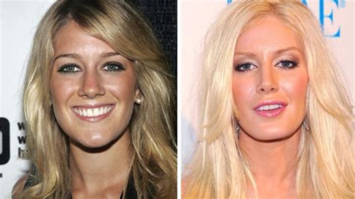 Bobbie Spencer Plastic Surgery Before And After Photos