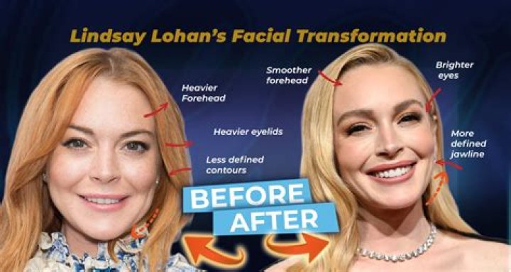Celebrity Lindsay Lohan plastic surgery, photos, video
