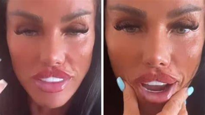 Celina Powell Reveals Cost Of Her Latest Plastic Surgery