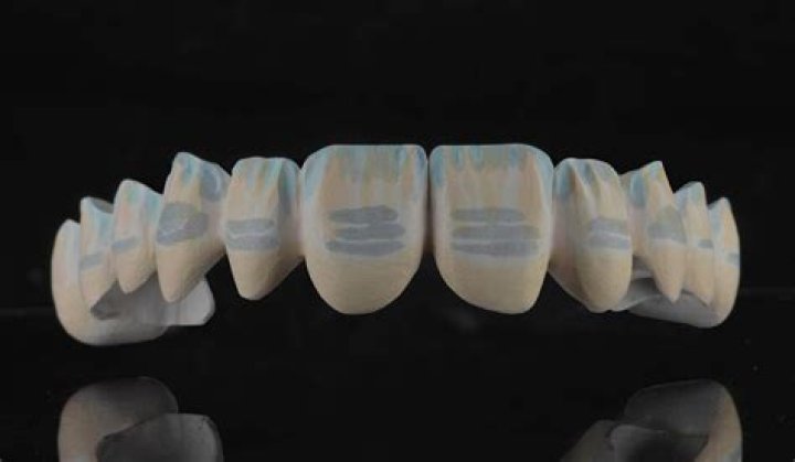 Clear And Esthetic, Gsctwo