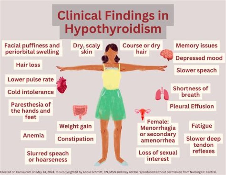 Clinical Features Of Hypothyroidism Mnemonic
