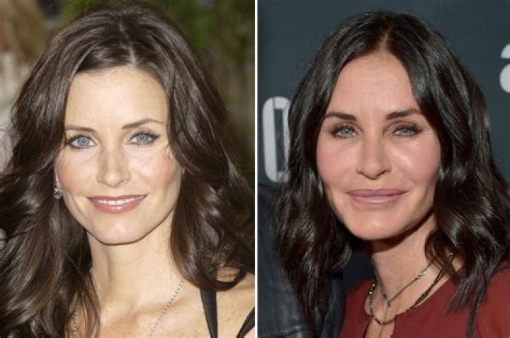 Courteney Cox on bad face work 'I'm looking really strange'