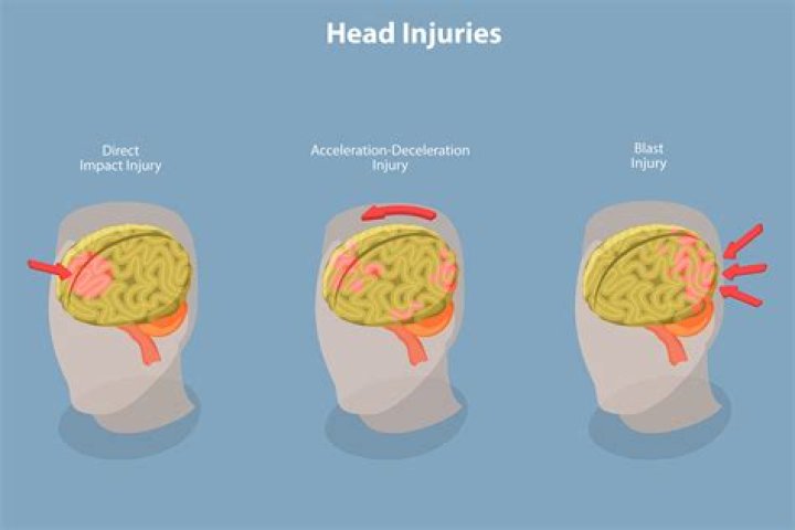 David Gergen Head Injury And Health Is He Sick Now?
