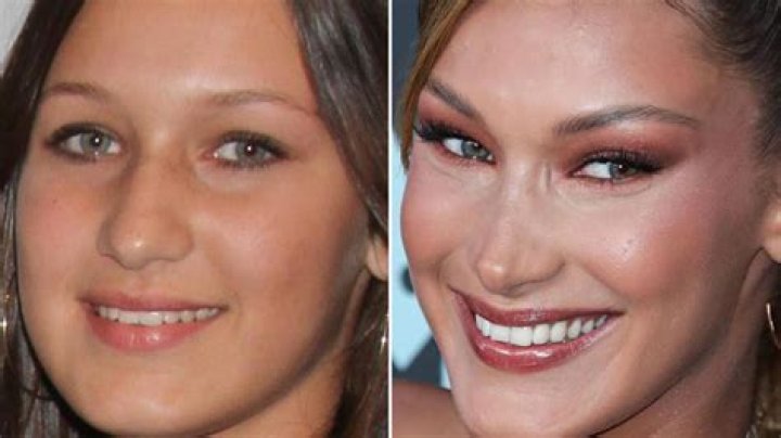 Did Bella Hadid get a nose job? Page Six