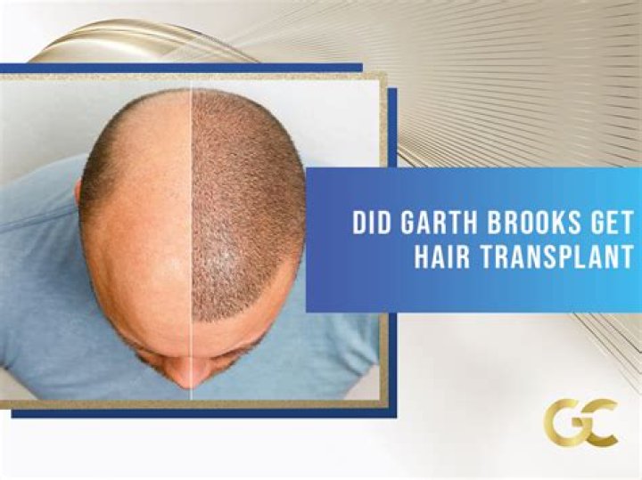 Did Garth Brooks Get Hair Plugs? His Inauguration Day Appearance Has