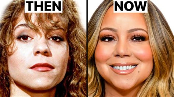 Did Mariah Carey Have Plastic Surgery? Experts Weigh In! (EXCLUSIVE)
