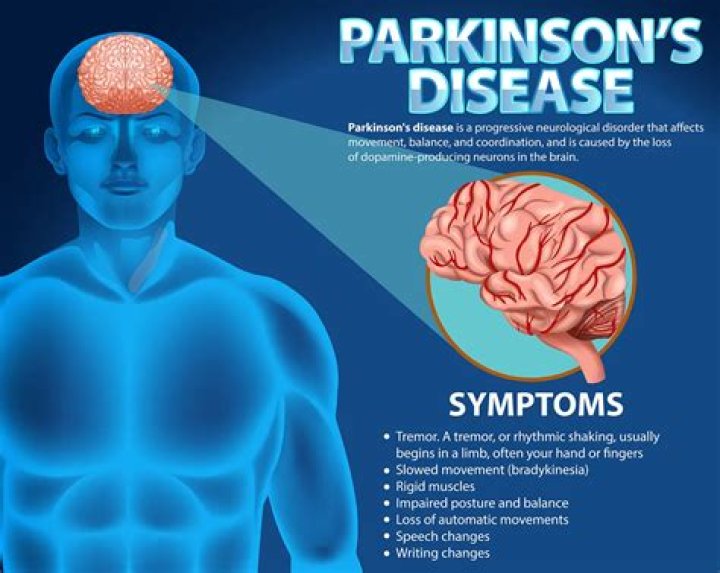 Does Paul Gosar have Parkinson's? Video showing GOP Rep shaking draws