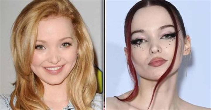 Dove Cameron Plastic Surgery A Few Suspicious Changes