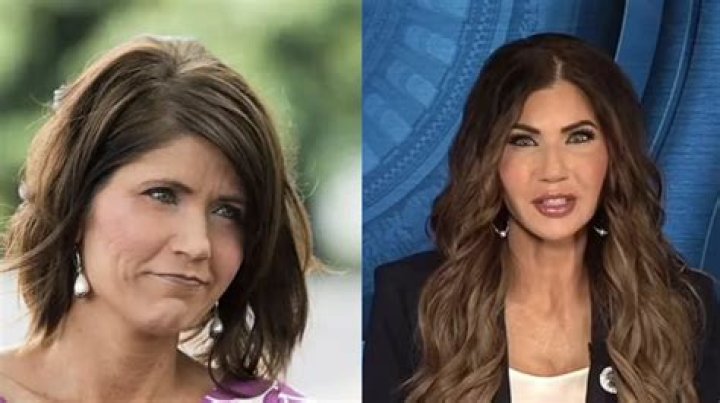 Exploring The Truth Behind Kristi Noem's Plastic Surgery Rumors