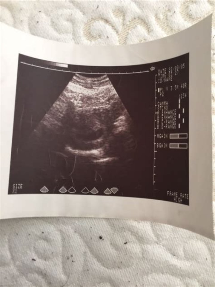 Fake ultrasounds, fake bellies and Fake a get US girl in