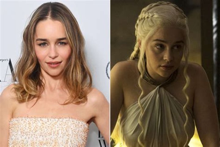 Game Of Thrones Star What Was Wrong With Darren Kent Face And Skin?