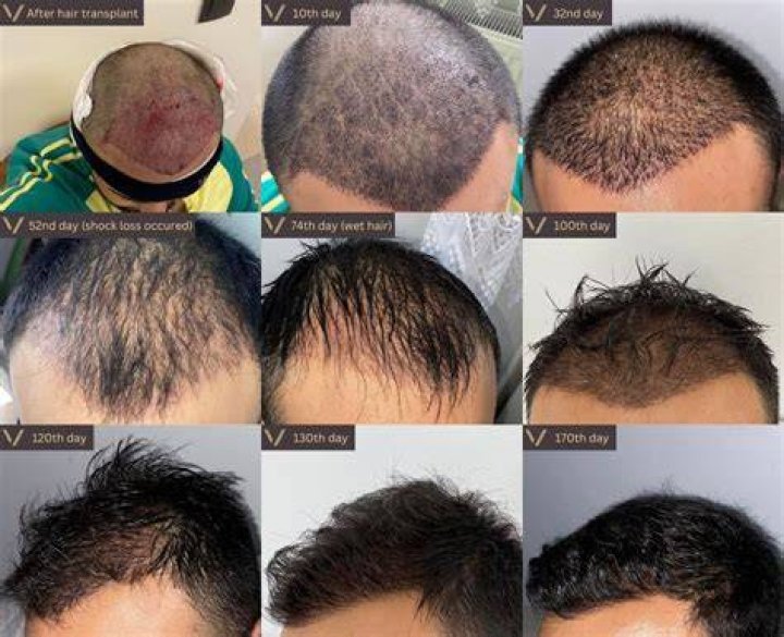 Hair, Gscsix