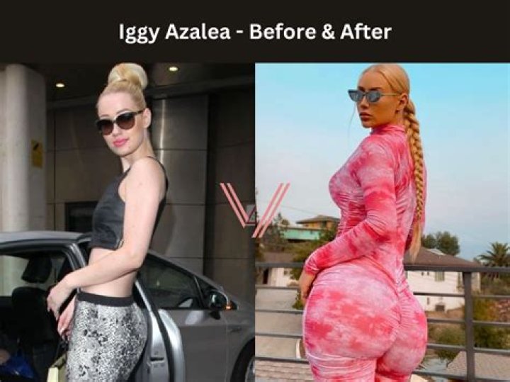 Iggy Azalea NUDE Pics Full Collection (UPDATED 2021!) Leaked Pie