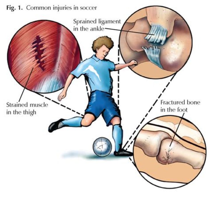 Injuries, Gscfour