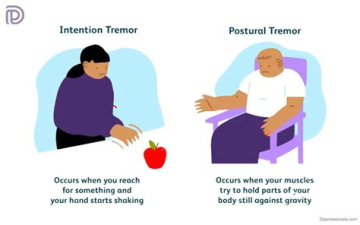 Intention Tremor What Is It, Causes, Diagnosis, Treatment and More