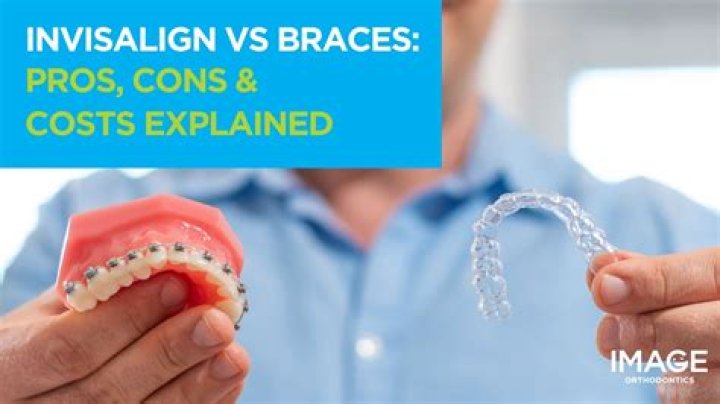 Invisalign Costs Roseville