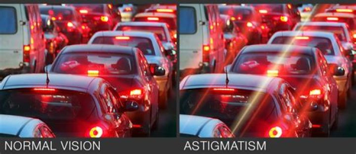 Is astigmatism 0 25 bad