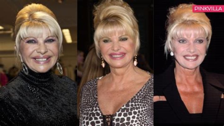 Ivana Trump Plastic Surgery: Before and After