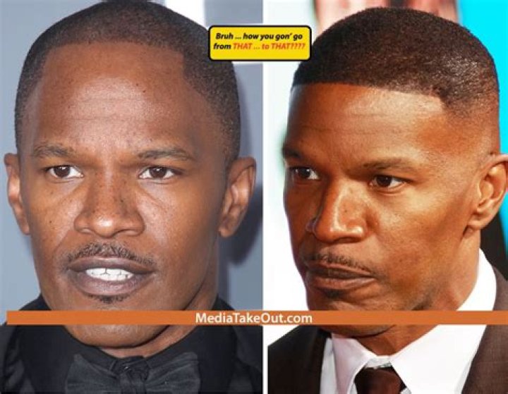Jamie Foxx Hairline Surgery Before And After Photos 2018 Plastic