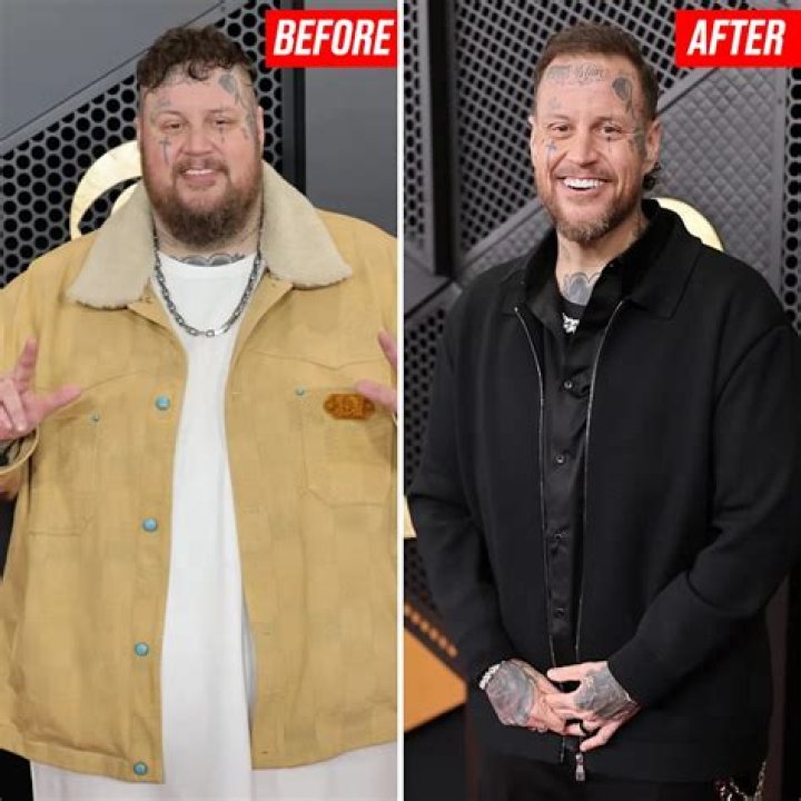 Jelly Roll Weight Loss This Fat Rapper Is Trying Hard for Maintaining