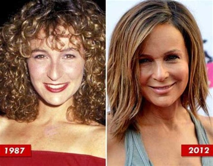 Jennifer Grey Before and After Plastic Surgery, Nose Job and More News