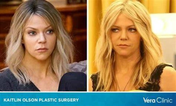 Kaitlin Olson&rsquo;s Plastic Surgery Rumors What Has the &lsquo;It&rsquo;s Always Sunny