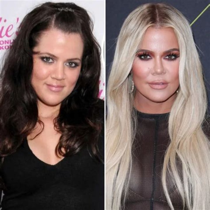 Khloe Kardashian Transformation Photos of Her Then and Now