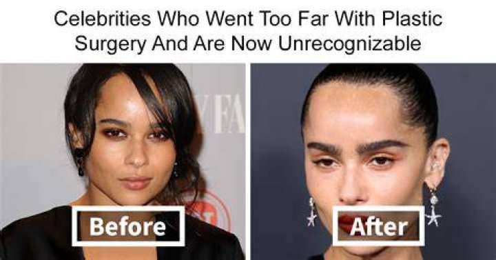 Kimbra's Transformation: The Truth About Plastic Surgery