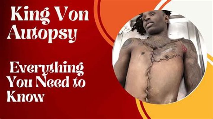 King Von's Autopsy Photo: Unveiling The Truth Behind The Tragedy