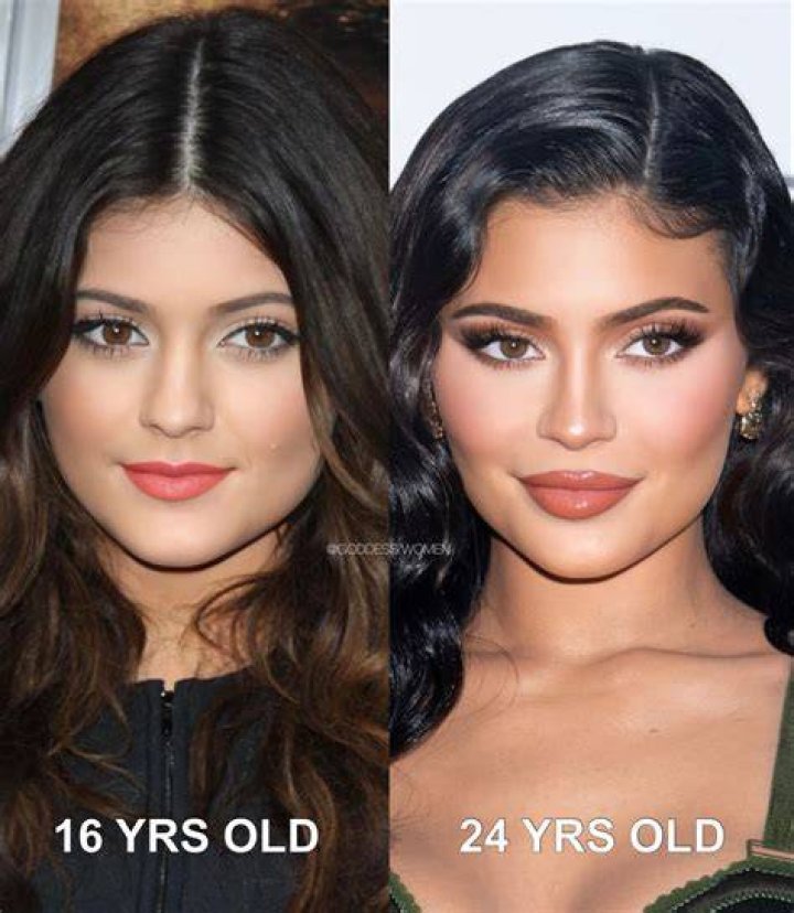 Kylie Jenner Plastic Surgery Before And After The Biggest Changes In