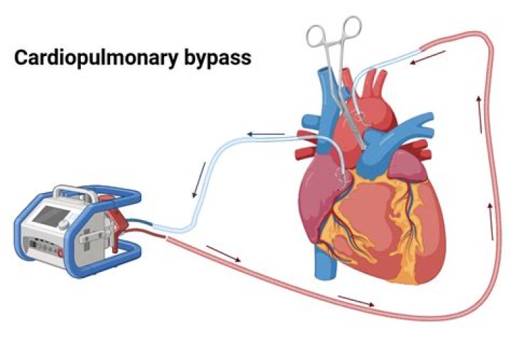 Label-1 Bypass