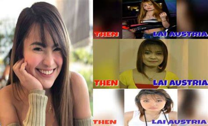 Lai Austria Old Photos Before Supposed Surgery Resurface? Netizens