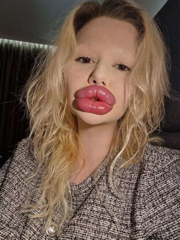 Lips, Gsctwo