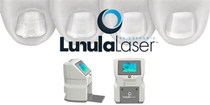 Lunula Laser