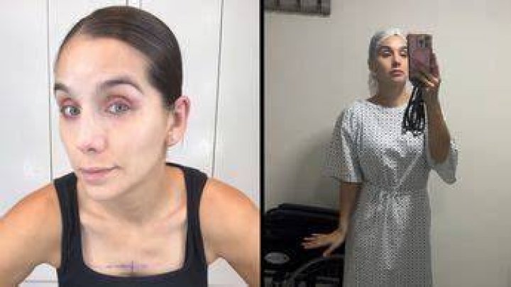 Marcela Mistral se somete a cirug&iacute;a pl&aacute;stica y muestra la realidad del