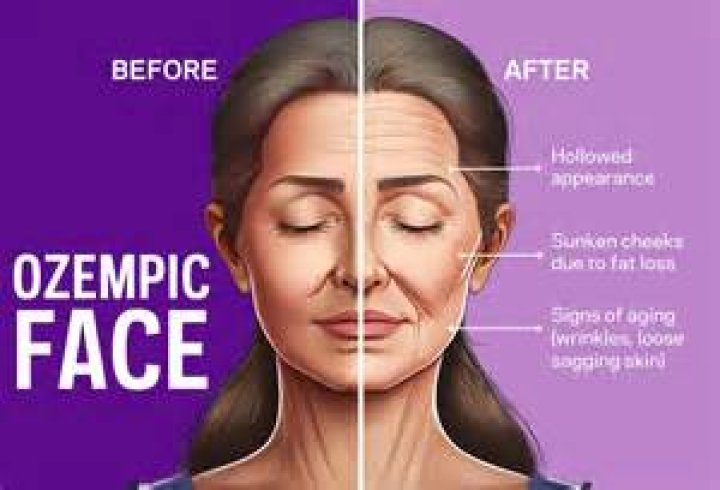 Mindy Kaling Ozempic Before After