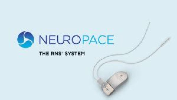 Neuropace - A Smarter Way To Treat Epilepsy"/><span itemprop=