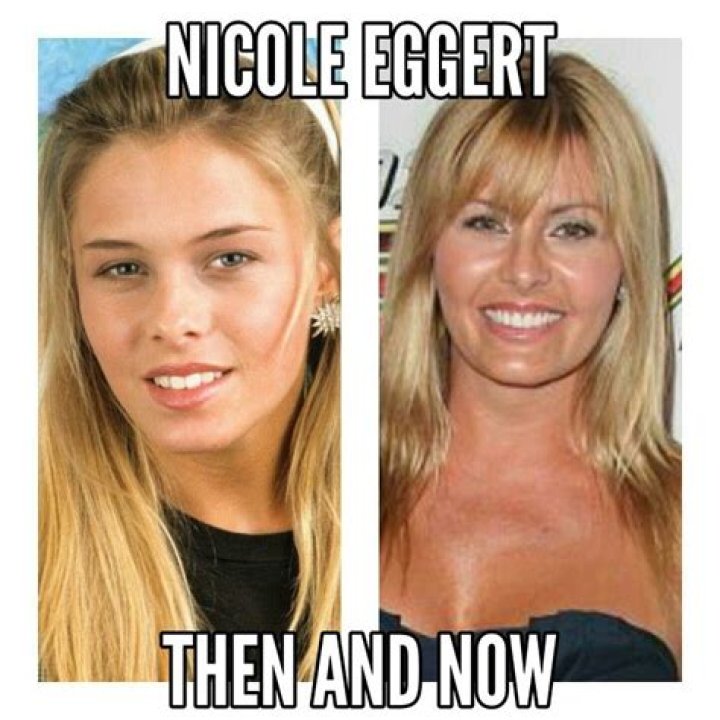 Nicole Eggert Then & Now See Photos Of ‘Baywatch’ Star Today