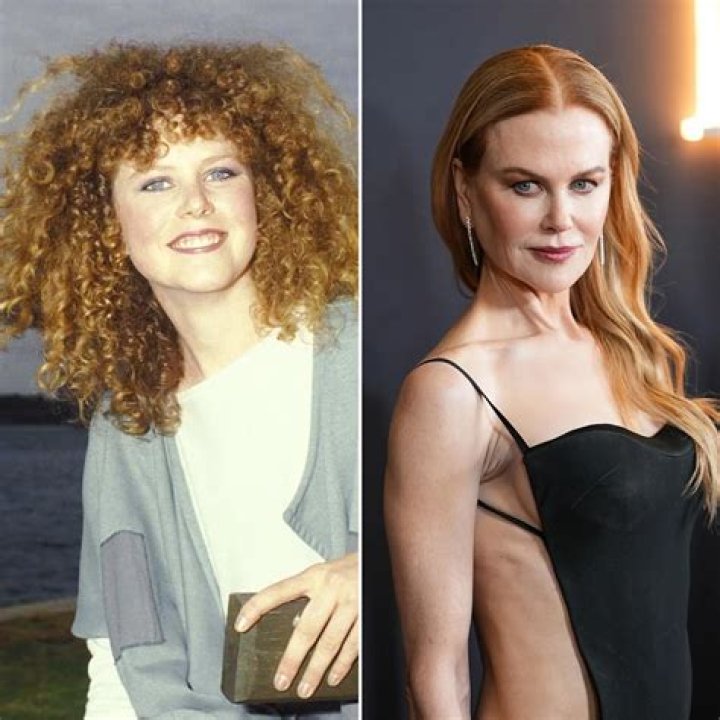 Nicole Kidman: The Truth Behind Her Plastic Surgery Rumors