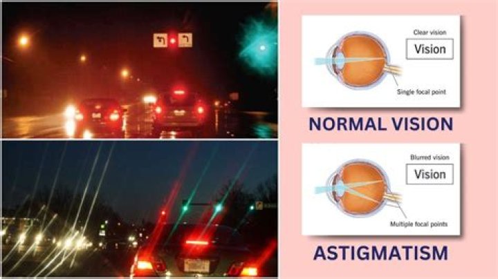 Picture Of Astigmatism At Night