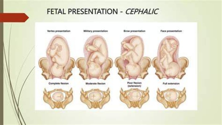 Position, Sniprhub